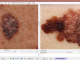 Photo Side-by-Side